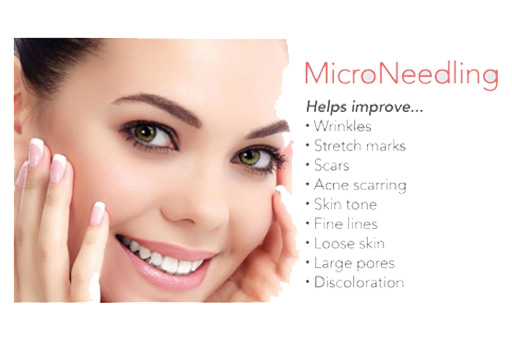 Lady showing Micro Needling Therapy